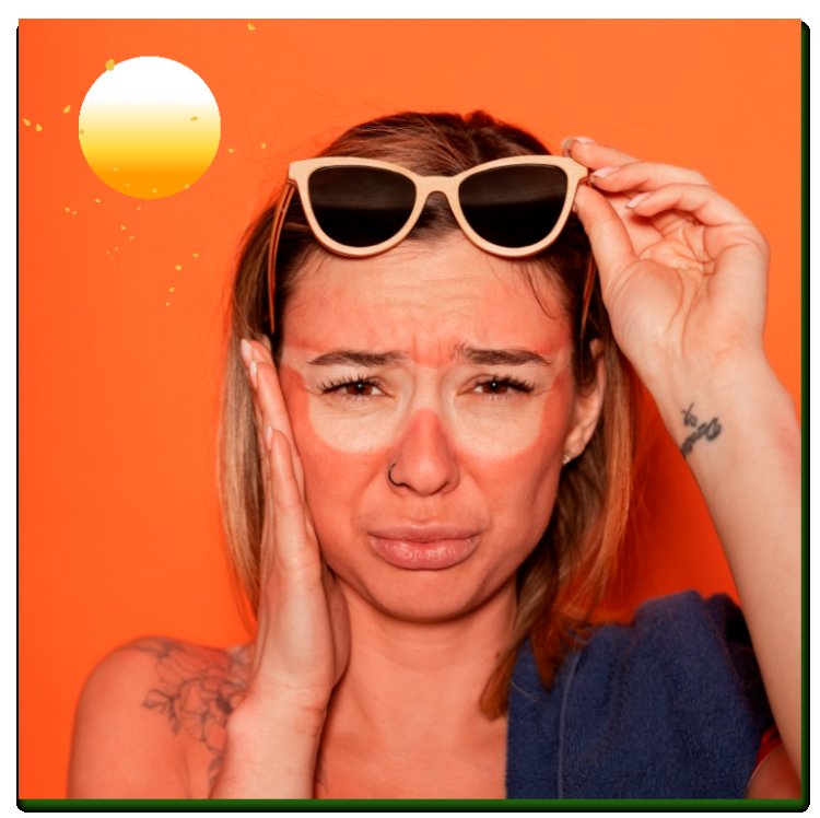 Uncovering & Exploring the Natural Home Remedies for Sunburn