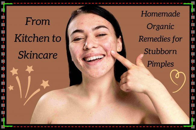 From Kitchen to Skincare: Homemade Organic Remedies for Stubborn Pimples and Acne