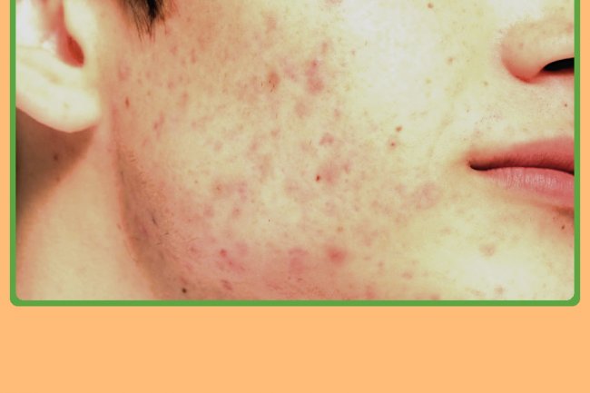 Crafting Your Skin's Destiny to Get Ageless Beauty; Remarkable Home Remedies to Brighten Pigmented Skin