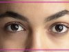 Home Remedies For Dark Circles: Organic Options For Brighter Eyes