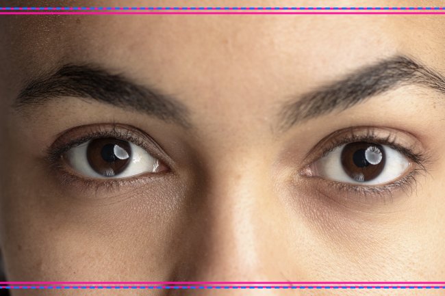 Home Remedies For Dark Circles: Organic Options For Brighter Eyes