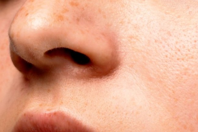 Explore The Organic Home Remedies for Large Open Skin Pores