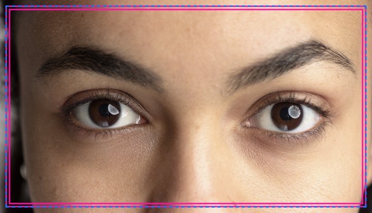 Home Remedies For Dark Circles: Organic Options For Brighter Eyes